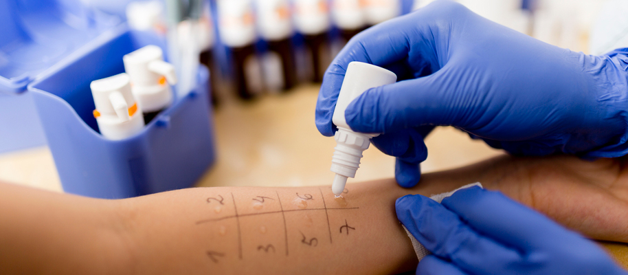   Come scoprire l'allergia : prick test e patch test 